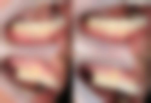 阜新王玮口腔预约挂号方式