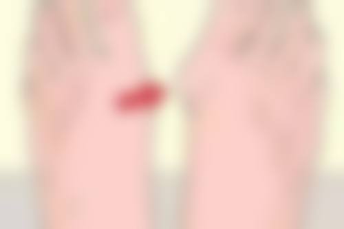 纾昕医生擅长项目解析