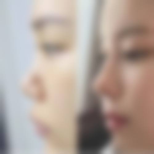 北京爱慕医疗美容医院治疗反馈与口碑评价。