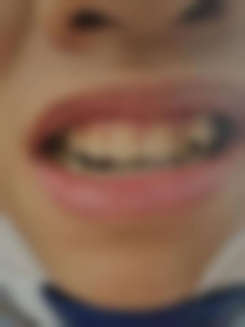 潍坊坊子亿希口腔医生团队经验稳定。