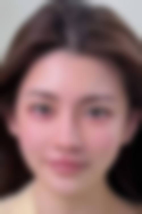 黔东南悦美新生医疗美容门诊部擅长项目