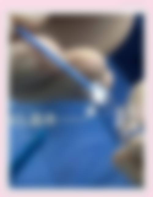福州东南眼科医院预约挂号方式。