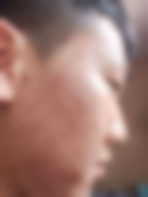 北京爱慕医疗美容医院预约挂号方式。