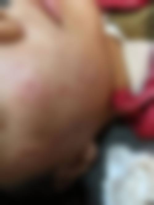 邯郸德美整形医院擅长项目。