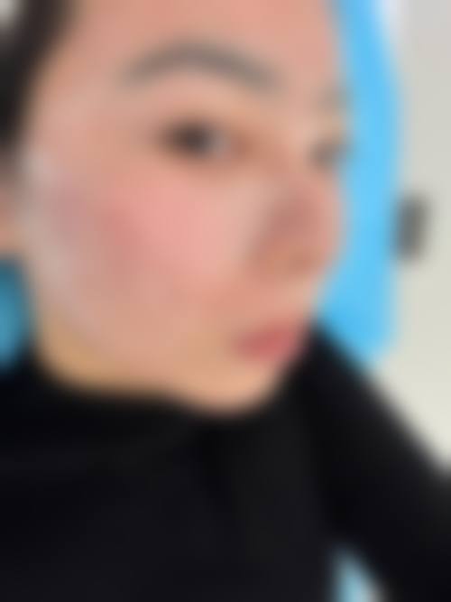 黔东南悦美新生医疗美容门诊部治疗反馈与口碑评价