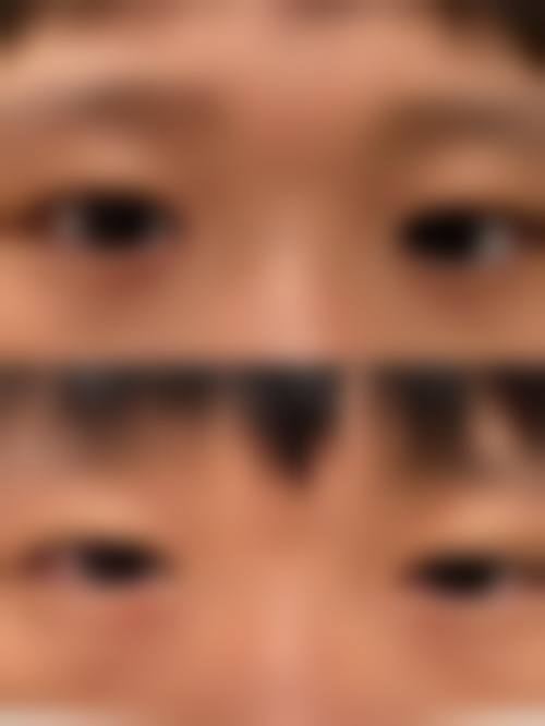 福州东南眼科医院门诊营业时间。