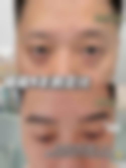 贵阳康馨整形美容医院治疗反馈与口碑评价。