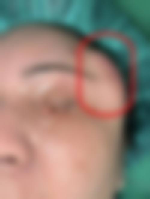贵阳康馨整形美容医院擅长项目。