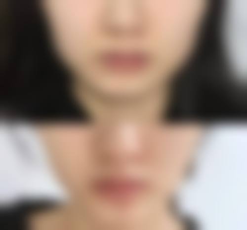 北京瀛美医疗美容擅长项目。
