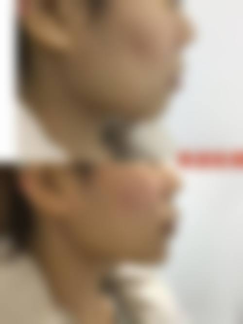 胡亚楠医生擅长项目