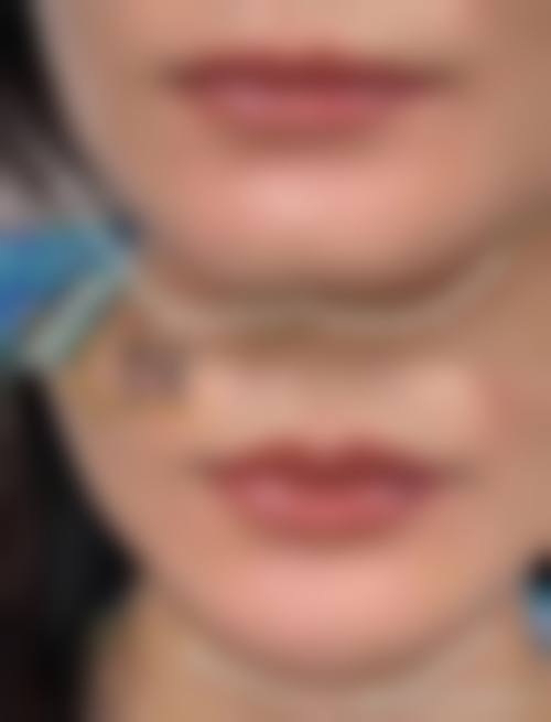 北京瀛美医疗美容医生团队经验稳定。
