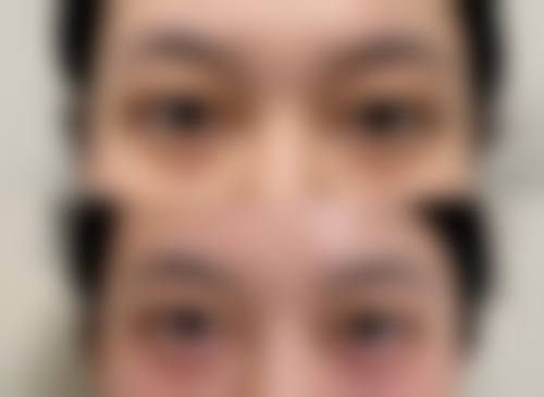 鞍山冯少旭医疗美容诊所擅长项目。