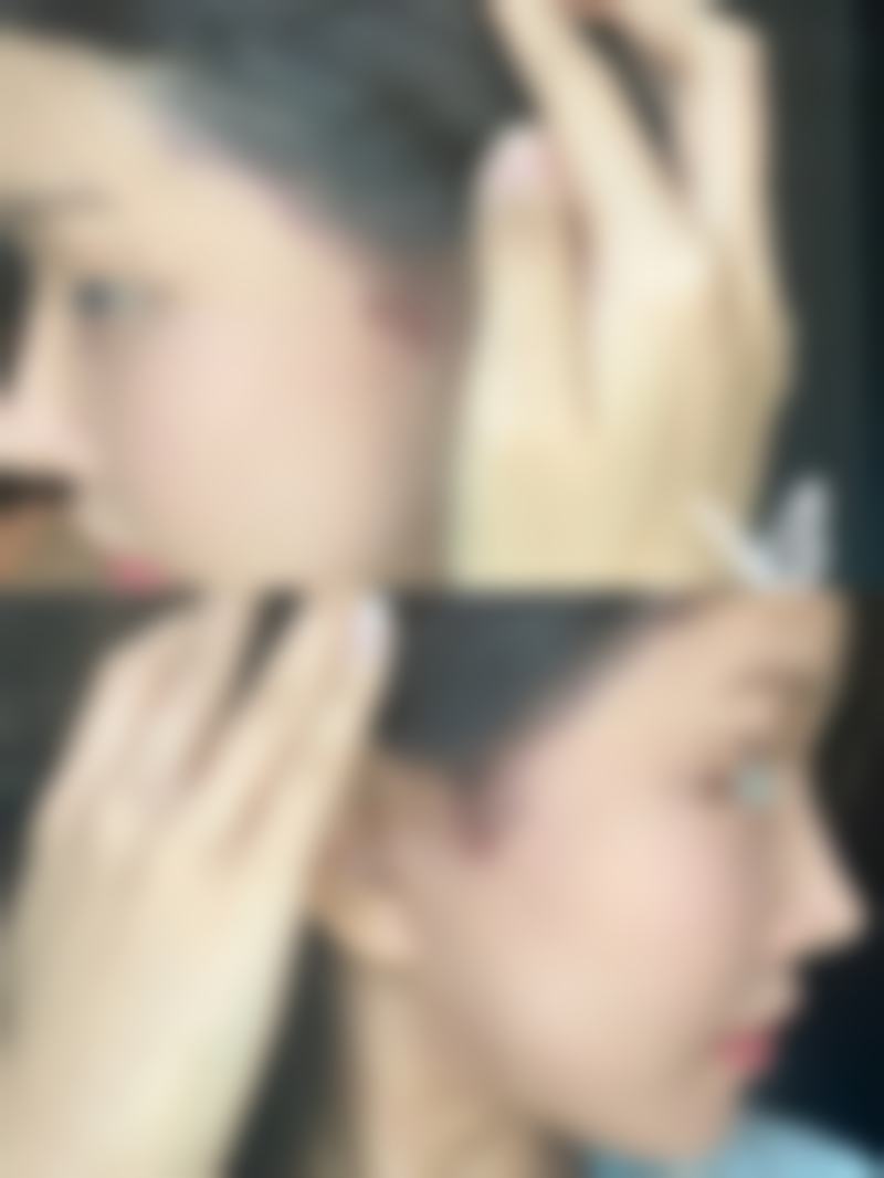 段宝莲医生的擅长项目