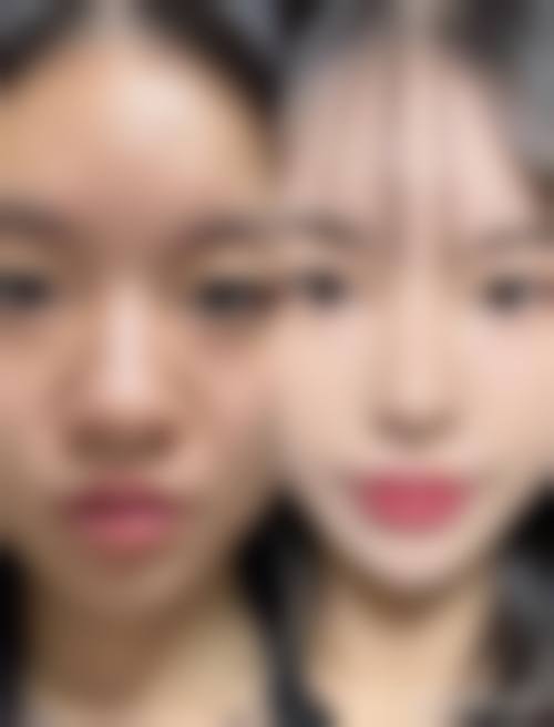 长春瑞澳医学美容擅长项目。