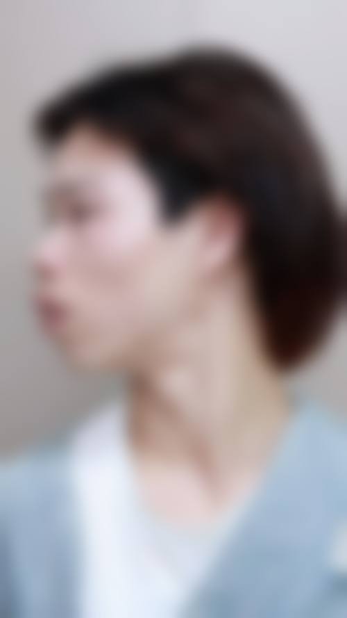 吉林通化王明曲口腔门诊部治疗反馈与口碑评价。