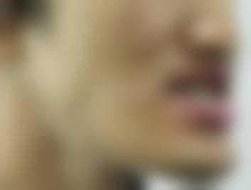 苏州米瑞口腔诊所的擅长项目
