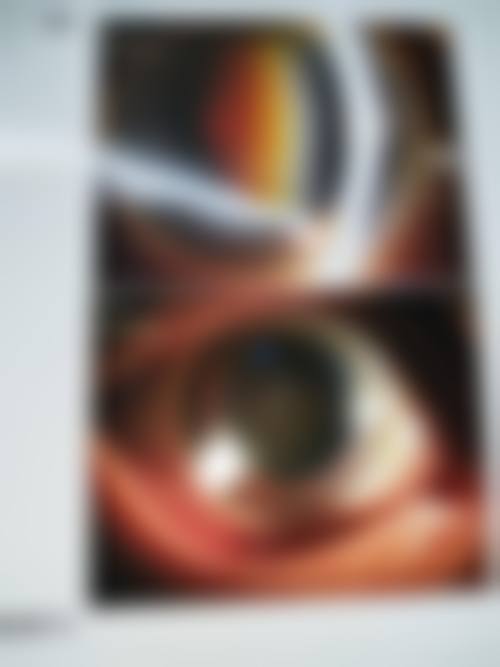 益阳爱尔眼科医院的口碑评价