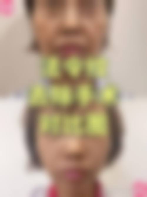 襄阳韩素医疗美容门诊部治疗反馈与口碑评价