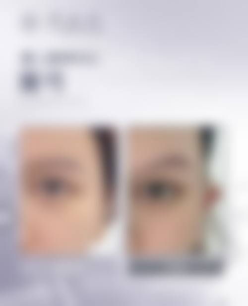 昆明同仁医院医疗美容科擅长项目。