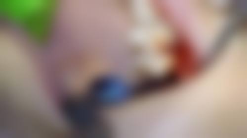 东莞大朗明居口腔治疗反馈与口碑评价。