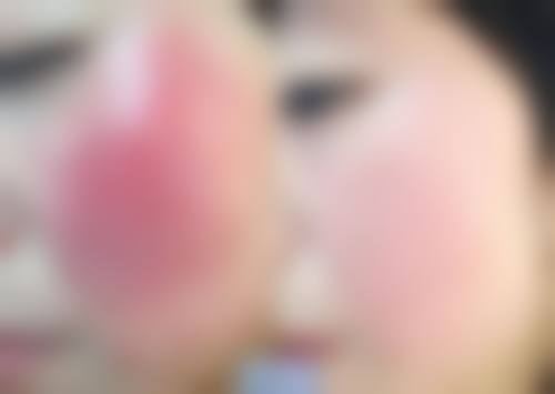 桂林医学校附属医院（烧伤创面整形外科、医学美容外科）2026年价格收费表：