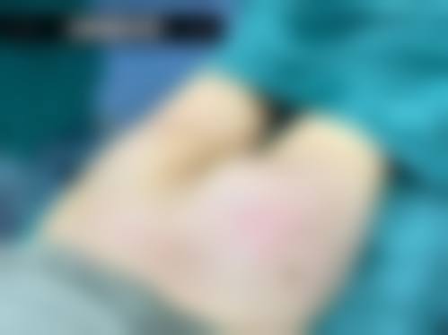 成都高新美质美致整形医院医生团队经验稳定。