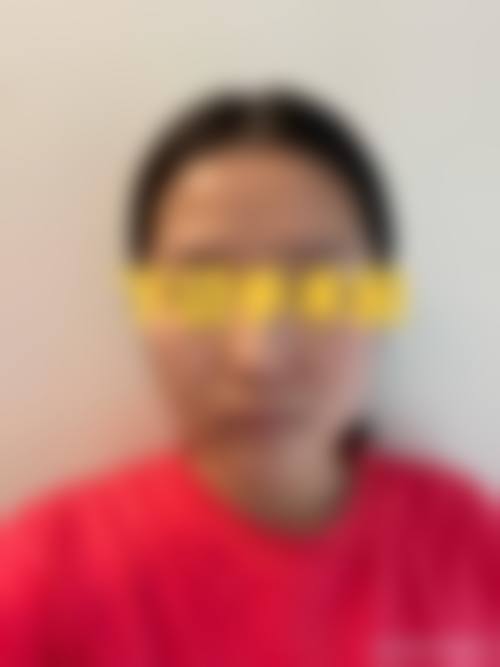 武汉慧丽源整形医院擅长项目