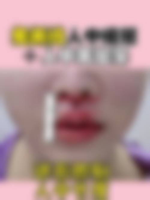 桂林医学校附属医院（烧伤创面整形外科、医学美容外科）地理位置便于到院。