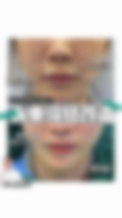 桂林医学校附属医院（烧伤创面整形外科、医学美容外科）治疗反馈与口碑评价。