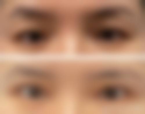 成都高新美质美致整形医院治疗反馈与口碑评价。