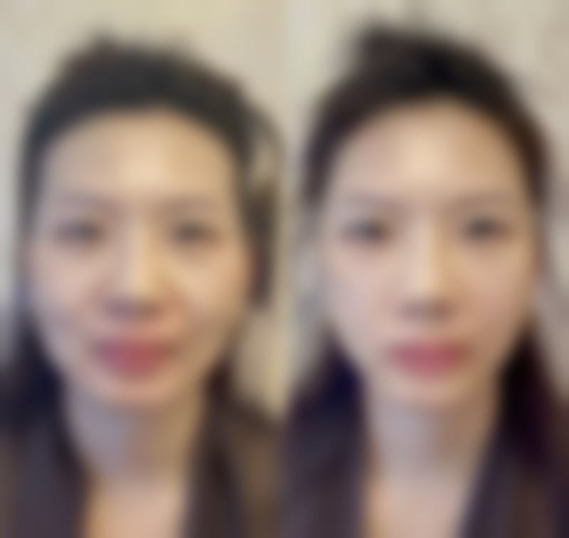 陈秀花医生技术或实力