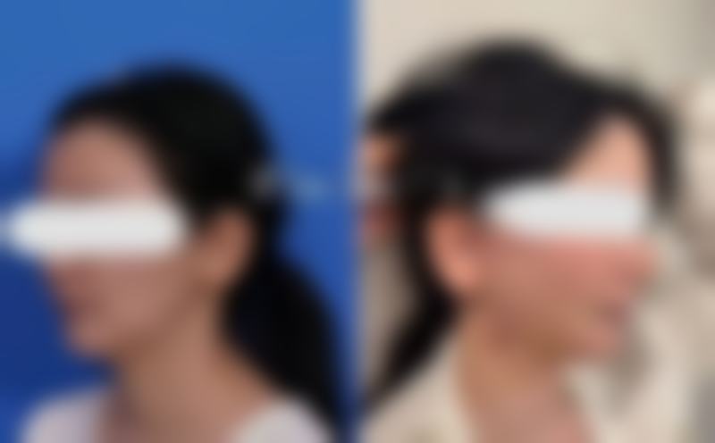 商丘刘义鹏医疗美容诊所的擅长项目