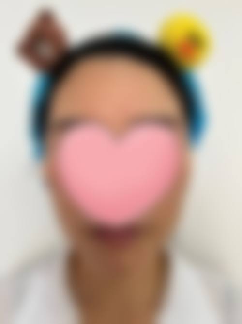 韩国ds clinic皮肤科预约挂号方式。
