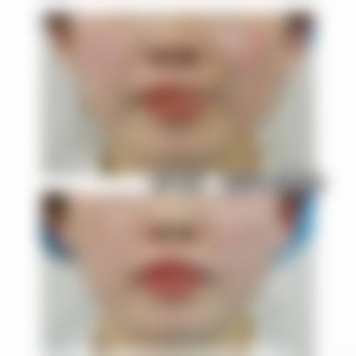 韩国ds clinic皮肤科地理位置便于到院。