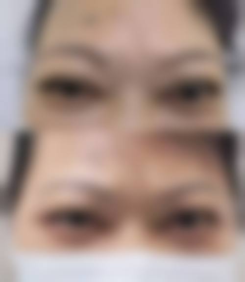 深圳市蛇口人民医院眼科预约挂号方式。
