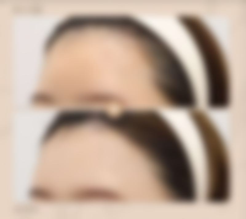 杭州芯美昕整形美容医院的擅长项目