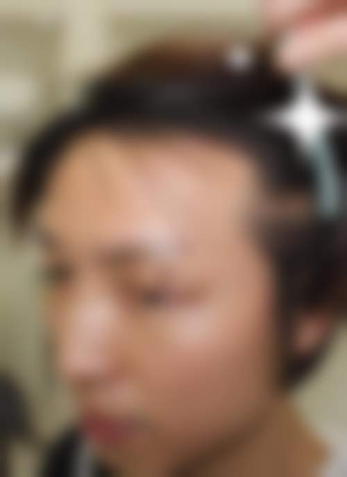 镇江美莱润丽医疗整形诊所更擅长什么手术