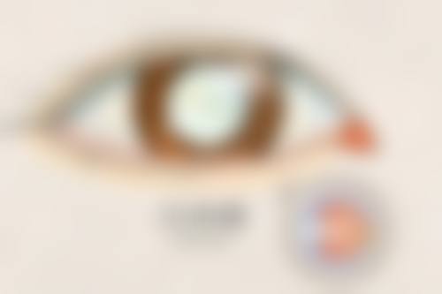 益阳爱尔眼科医院的口碑评价