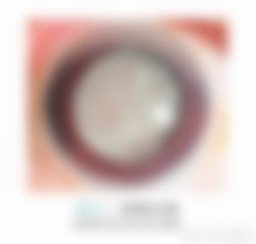 益阳爱尔眼科医院擅长的项目