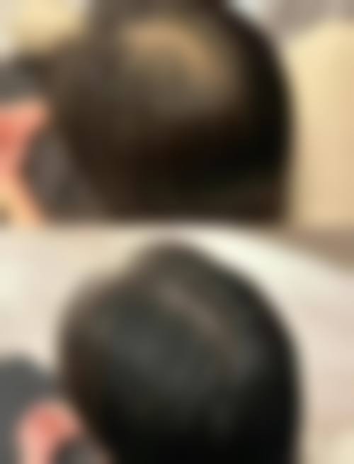 成都首瑞毛发移植医疗美容诊所整形科医生团队经验稳定。