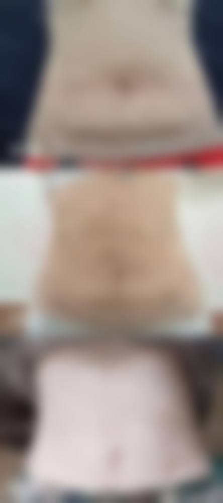 南昌黛妍整形医院擅长项目。