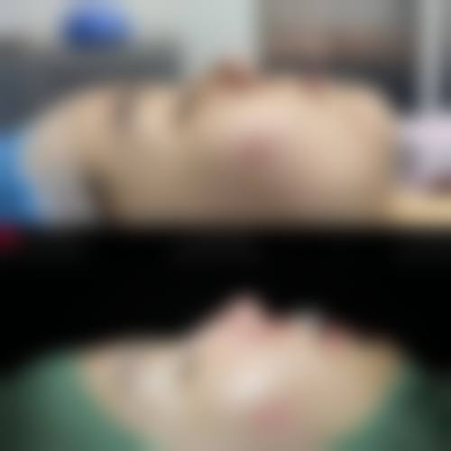 成都首瑞毛发移植医疗美容诊所整形科治疗反馈与口碑评价。