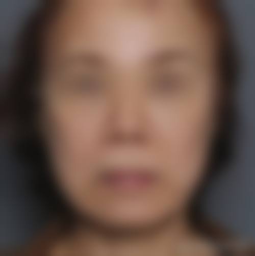 南昌黛妍整形医院治疗反馈与口碑评价。