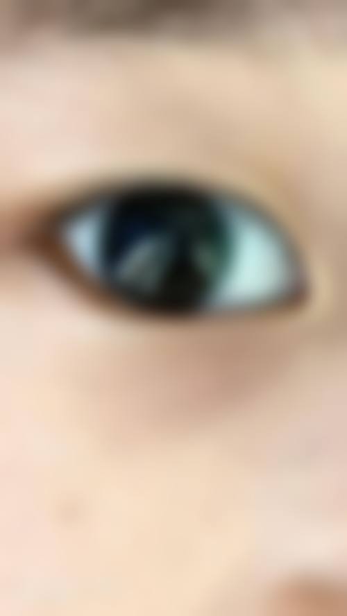吐鲁番美尼康眼科医院治疗反馈与口碑评价