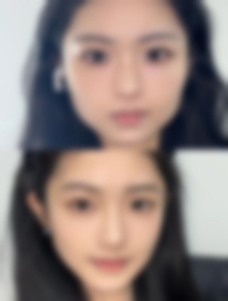 济南嘉丽整形医院设备优势