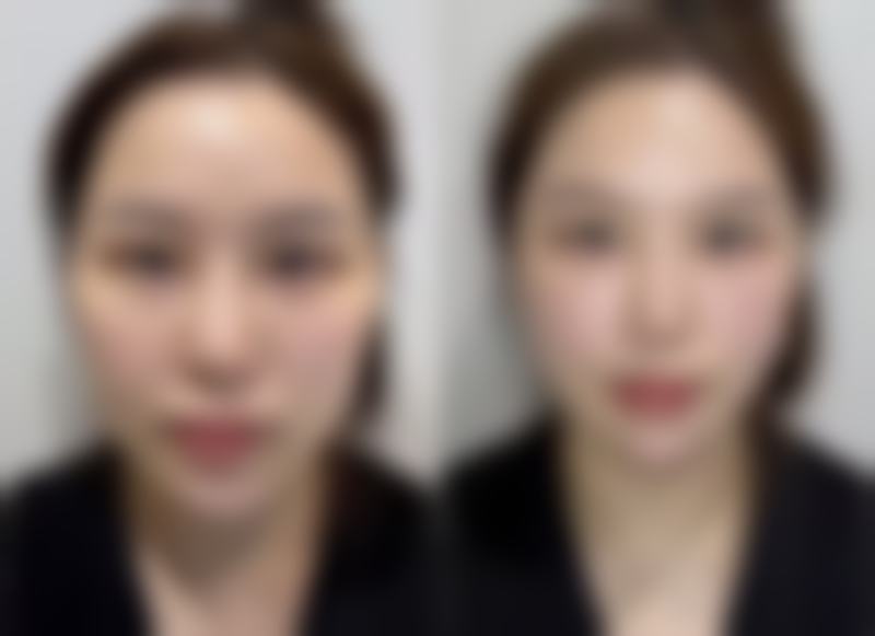 南京春语整形医院的乘车路线与口碑评价