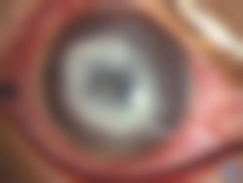 佛山三水华厦眼科治疗反馈与口碑评价。
