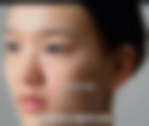 浙江杭州新生植发治疗反馈与口碑评价。