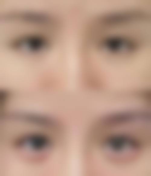成都福爱整形医院预约挂号方式。