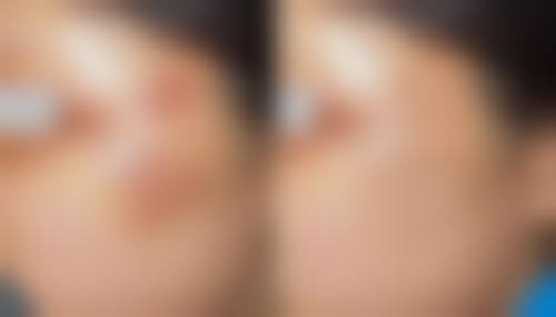 李保医生擅长项目